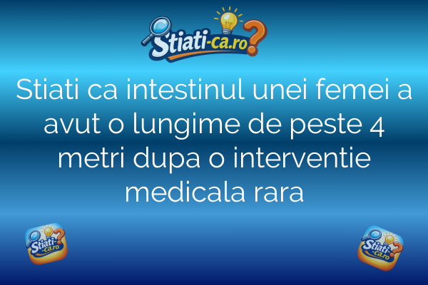Stiati ca intestinul unei femei a avut o lungime de peste 4 metri dupa o interventie medicala rara