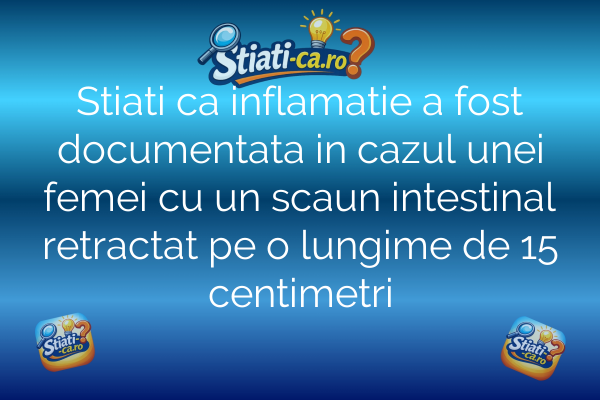 Stiati ca inflamatie a fost documentata in cazul unei femei cu un scaun intestinal retractat pe o lungime de 15 centimetri