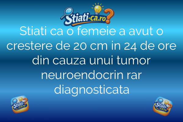 Stiati ca o femeie a avut o crestere de 20 cm in 24 de ore din cauza unui tumor neuroendocrin rar diagnosticata